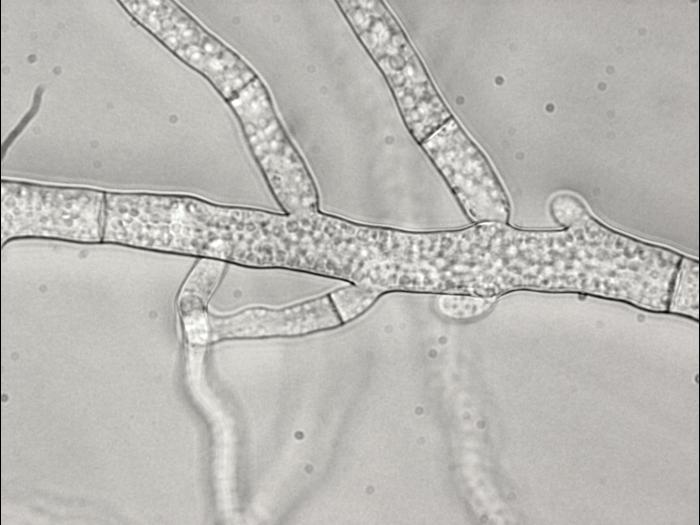 Sclerotinia sp.