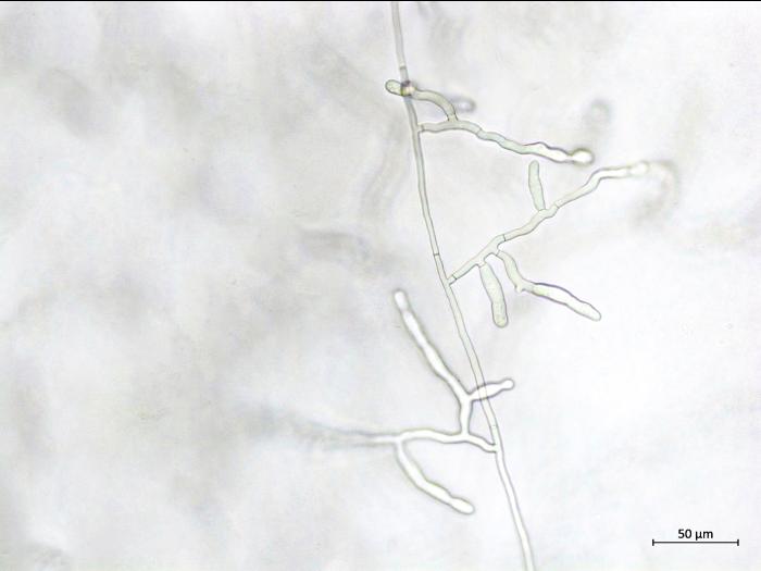 Rhizoctonia_sp_3
