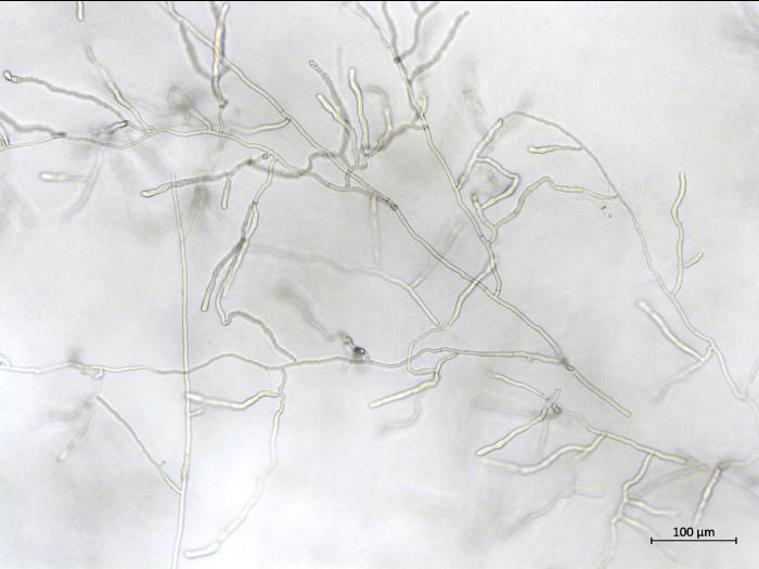 Rhizoctonia_sp_5