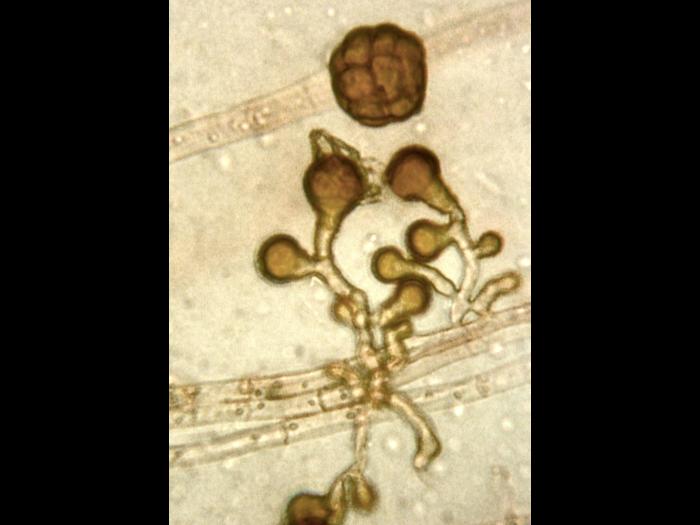 Epicoccum sp.