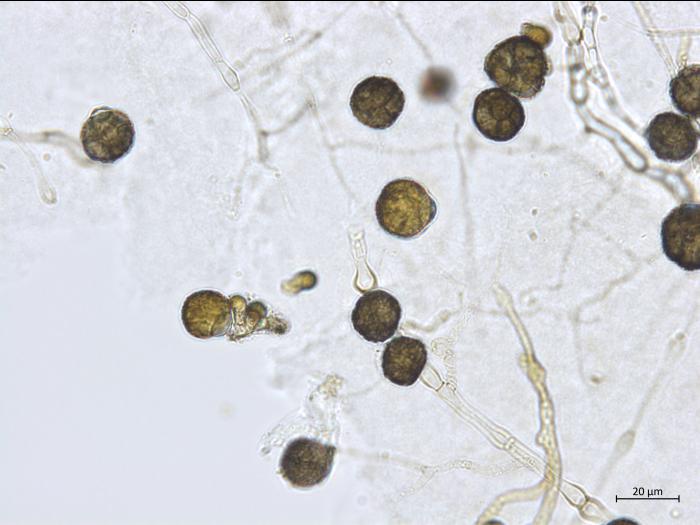 Epicoccum sp.