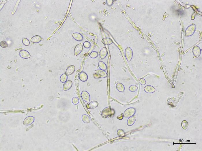 Phytophthora infestans - sporange