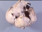 Ail - Charbon (Urocystis magica)