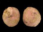 Pomme de terre - Gale poudreuse (Spongospora subterranea)