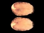 Pomme de terre - Pourriture rose (Phytophthora erythroseptica)