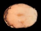 Pomme de terre - Pourriture rose (Phytophthora erythroseptica)