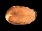Pomme de terre - Pourriture rose (Phytophthora erythroseptica)