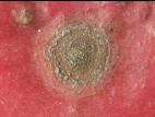 Pomme - Tavelure (Venturia inaequalis)_10