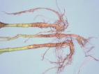 Haricot - Rhizoctone commun (Rhizoctonia solani)_1
