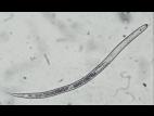 Heterodera glycines