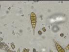 Alternaria porri_55604-2