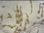 Alternaria_alternata-02_LQ