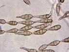 Alternaria_alternata-03_LQ