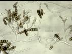 Alternaria_brassicicola-04_LQ