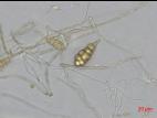 Alternaria_cucumerina_D45203_1_lq.jpg