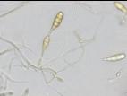 Alternaria_cucumerina_D45203_2_lq.jpg