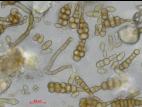 Alternaria_cucumerina_D52977-1_LQ.jpg