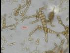 Alternaria_cucumerina_D52977-3_LQ.jpg