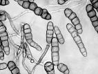 Alternaria_helianthi-02_LQ