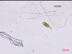 Alternaria_japonica_D34952-2_LQ