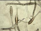 Alternaria_porri-02_LQ