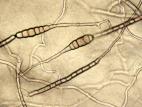 Alternaria_porri-04_LQ