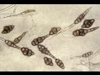 Alternaria_raphani_04_LQ.jpg