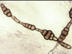 Alternaria_raphani-05_LQ