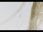 Alternaria_rostrum_D46202-2_LQ.jpg
