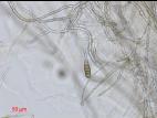 Alternaria_solani_D35066-1_LQ