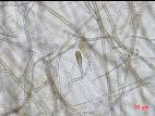 Alternaria_solani_D35066_lq.jpg