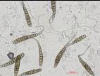 Alternaria_solani_D53639_A_LQ.jpg