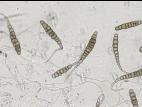Alternaria_solani_D53639_B_LQ.jpg