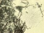 Chaetomium-11_LQ