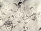 Cladosporium_phlei-01