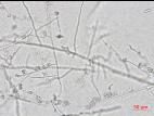 Colletotrichum_coccodes_D35079-1_LQ