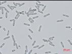 Colletotrichum_coccodes_D35079-3_LQ
