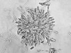 Colletotrichum_gloeosporioides-02