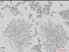 Coniella_diplodiella_D33070-3_LQ