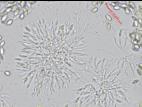 Coniella_diplodiella_D33070-4