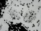 Coniella_fragariae-21