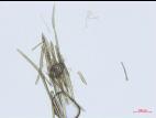 Corynespora_cassiicola_D55060-1_Conidie_LQ