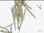 Corynespora_cassiicola_D55060-3_Conidie_LQ