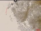 Cryptosporiopsis_tarraconensis_D42630_Conidiophores_Conidies