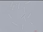 Cylindrocarpon_D27080-1_LQ