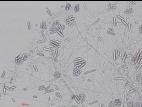 Cylindrocarpon_D27080-2_LQ