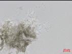 Cytospora_D47367-1_LQ