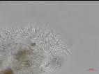 Cytospora_leucostoma_D44677-2_Conidiophores_LQ