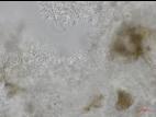 Cytospora_leucostoma_D44677-3_Conidiophores_LQ
