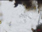 Diplodia_seriata_D43390-1_Cellules_conidio_LQ